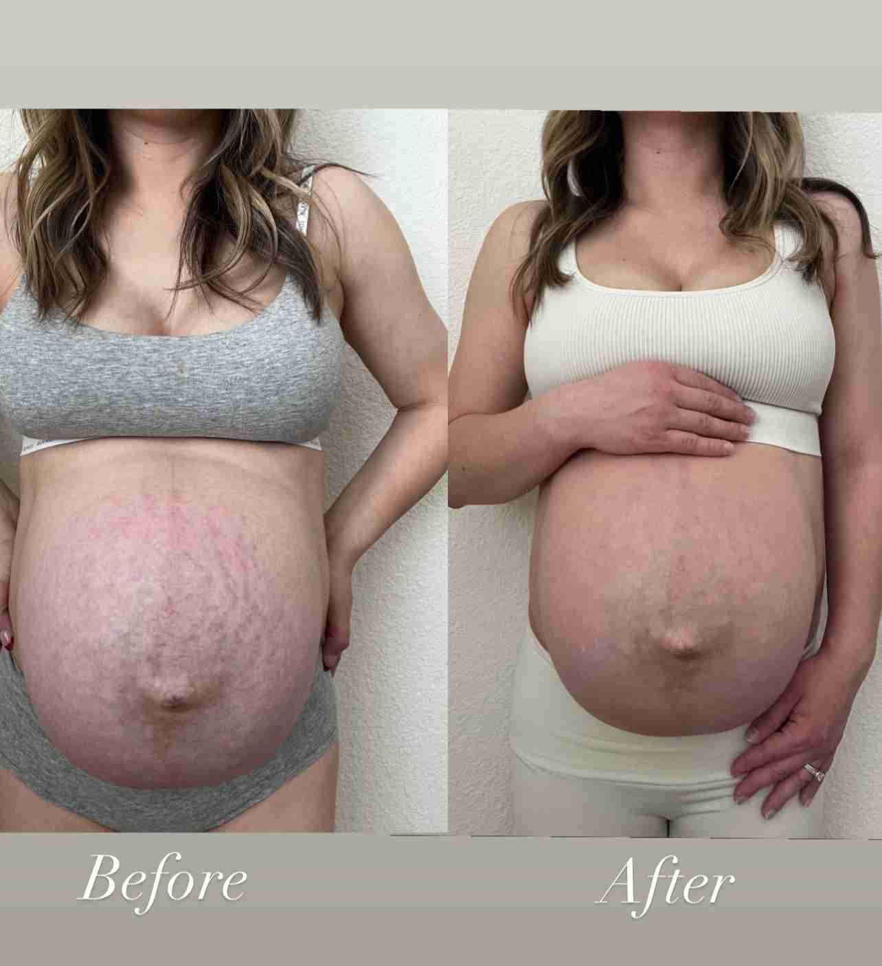 Nourishing Belly Oil